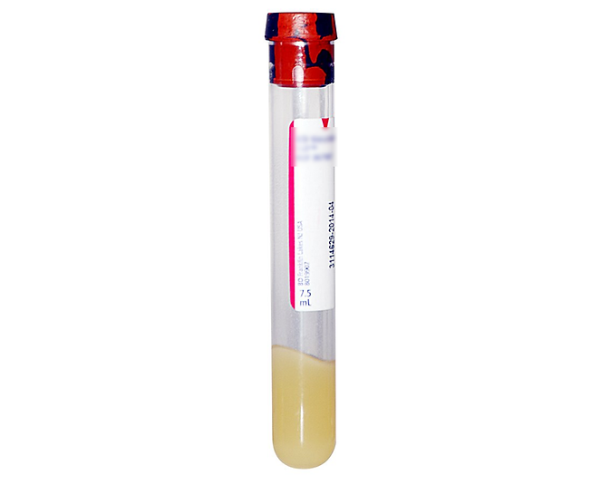 BT4988 TUBE BLOOD COLLECTION, SST, RED GREY STRIP. TOP