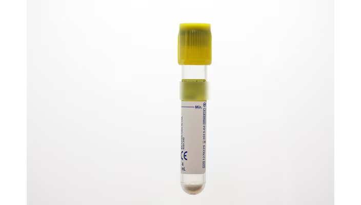 BT4953 TUBE URINE/ C&S 4ML